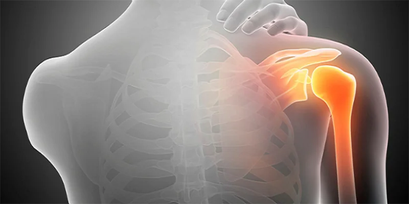 Ayurvedic treatment for frozen shoulder