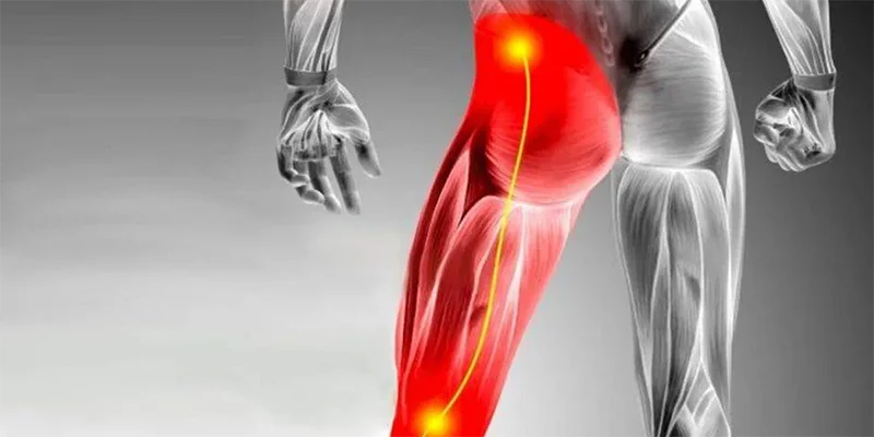 Ayurvedic treatment for sciatica nerve pain